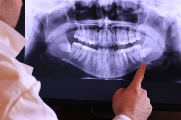 Best Emergency Tooth Extraction in Callaway, FL